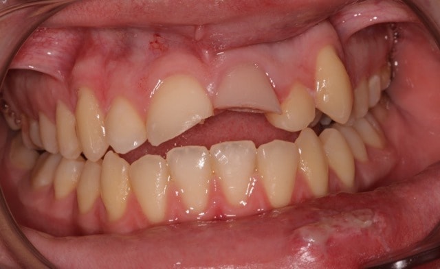 Southington Dentistry | Dental Emergencies, Dental Bridges and Family Dentistry in Southington