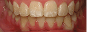 Southington Dentistry | Family Dentistry in Southington, Cosmetic Dentistry and Sedation Dentistry