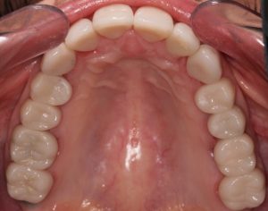 Southington Dentistry | Clenching and Grinding, Sedation Dentistry and Cosmetic Dentistry