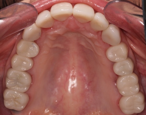 Southington Dentistry | Dental Emergencies, Dental Fillings and Gum Disease