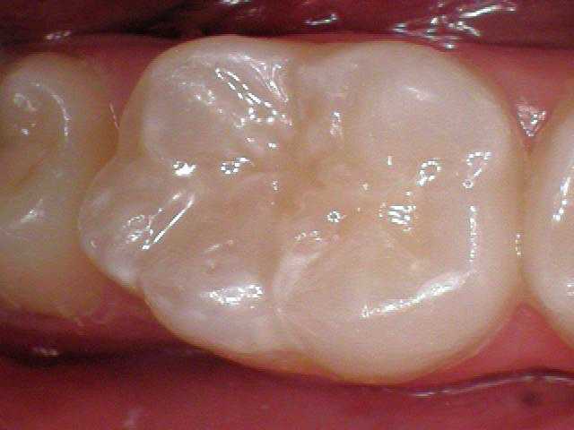 Southington Dentistry | Cosmetic Dentistry, Teeth Whitening and Dental Bridges