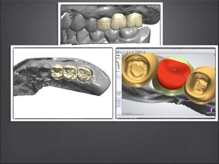 Southington Dentistry | Cosmetic Dentistry, Drill-Less Dentistry and Family Dentistry in Southington