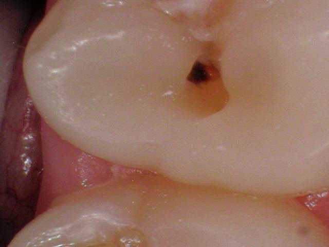 Southington Dentistry | Dental Crowns, Root Canals and Sedation Dentistry