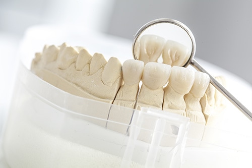 Southington Dentistry | Dental Crowns, Teeth Whitening and Root Canals