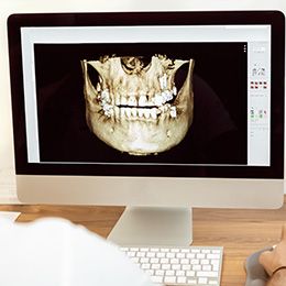 Southington Dentistry | Teeth Whitening, Plantsville Dental Implants and Dental Crowns