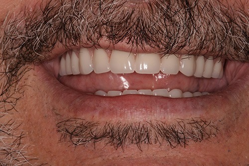 Southington Dentistry | Cosmetic Dentistry, Dental Fillings and Sedation Dentistry