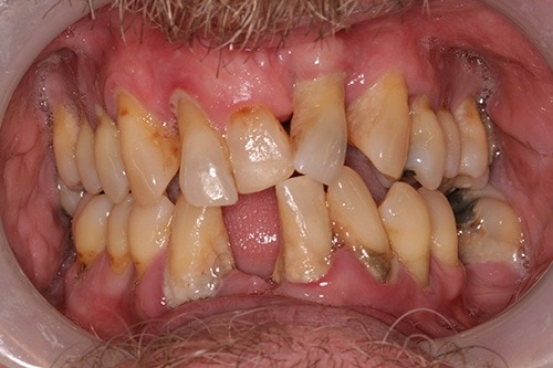 Southington Dentistry | Dental Extractions in Southington, Family Dentistry in Southington and Southington Veneers