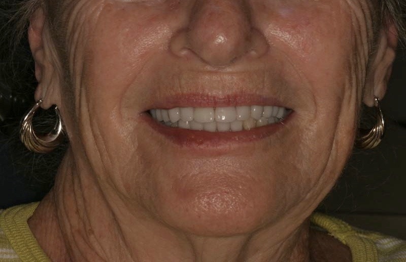 Southington Dentistry | Root Canals, Family Dentistry in Southington and Plantsville Dental Implants